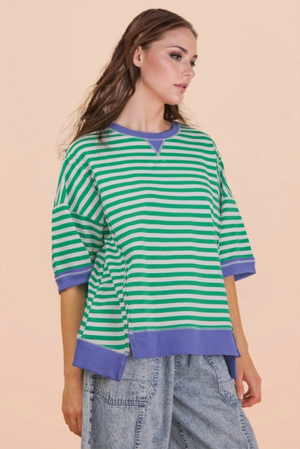 Oversized Stripe Top